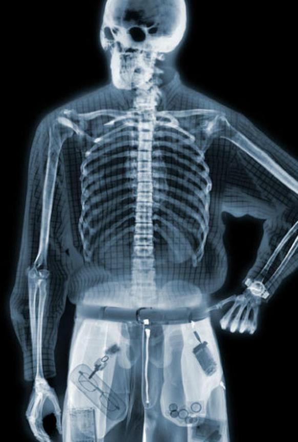 X-Ray Body Simulator Prank